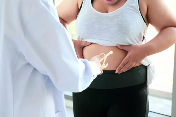 Postbariatrik Cerrahi Fiyatları