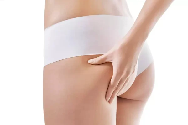 Brezilya Kalça Estetiği