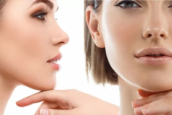 Burun Estetiğinde Doğal Görünüm Nasıl Planlanır?