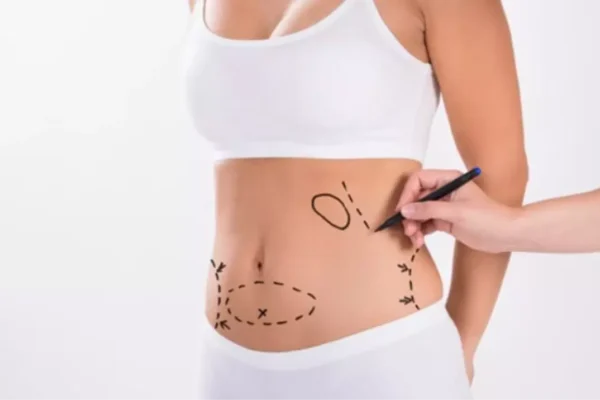 Karın Germe Ameliyatı Kilo Vermeye Yardımcı Olur mu?