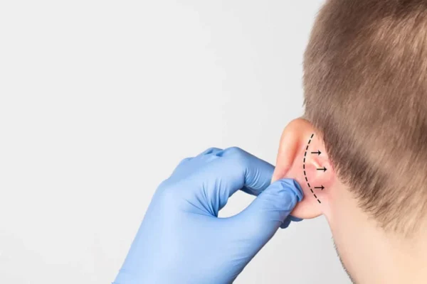 Kepçe Kulak Estetiği Kaç Yaşında Yapılır?