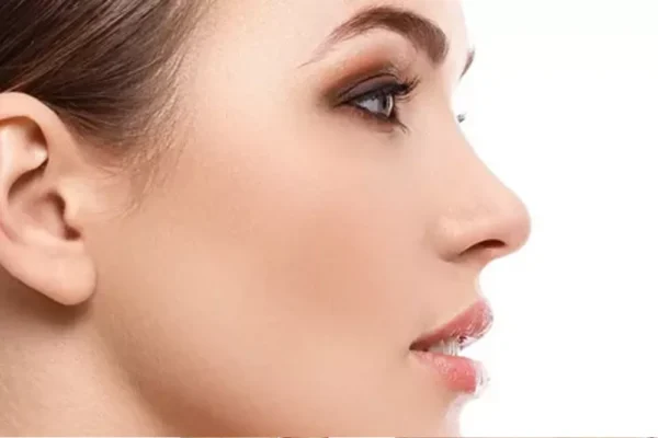 Sekonder Burun Ameliyatı