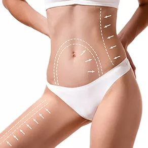 Vaser Liposuction Hangi Bölgelere Uygulanır?