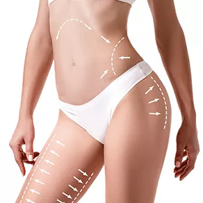 Vaser Liposuction Ameliyatından Sonra Hastanede Kalır mıyım?