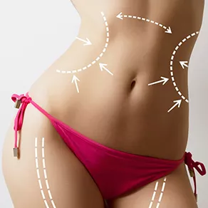 Vaser Liposuction Ameliyatından Sonra İş Hayatına Dönüş Ne Zaman Olur?