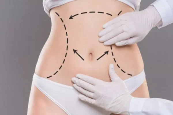 Vücut Germe Ameliyatları